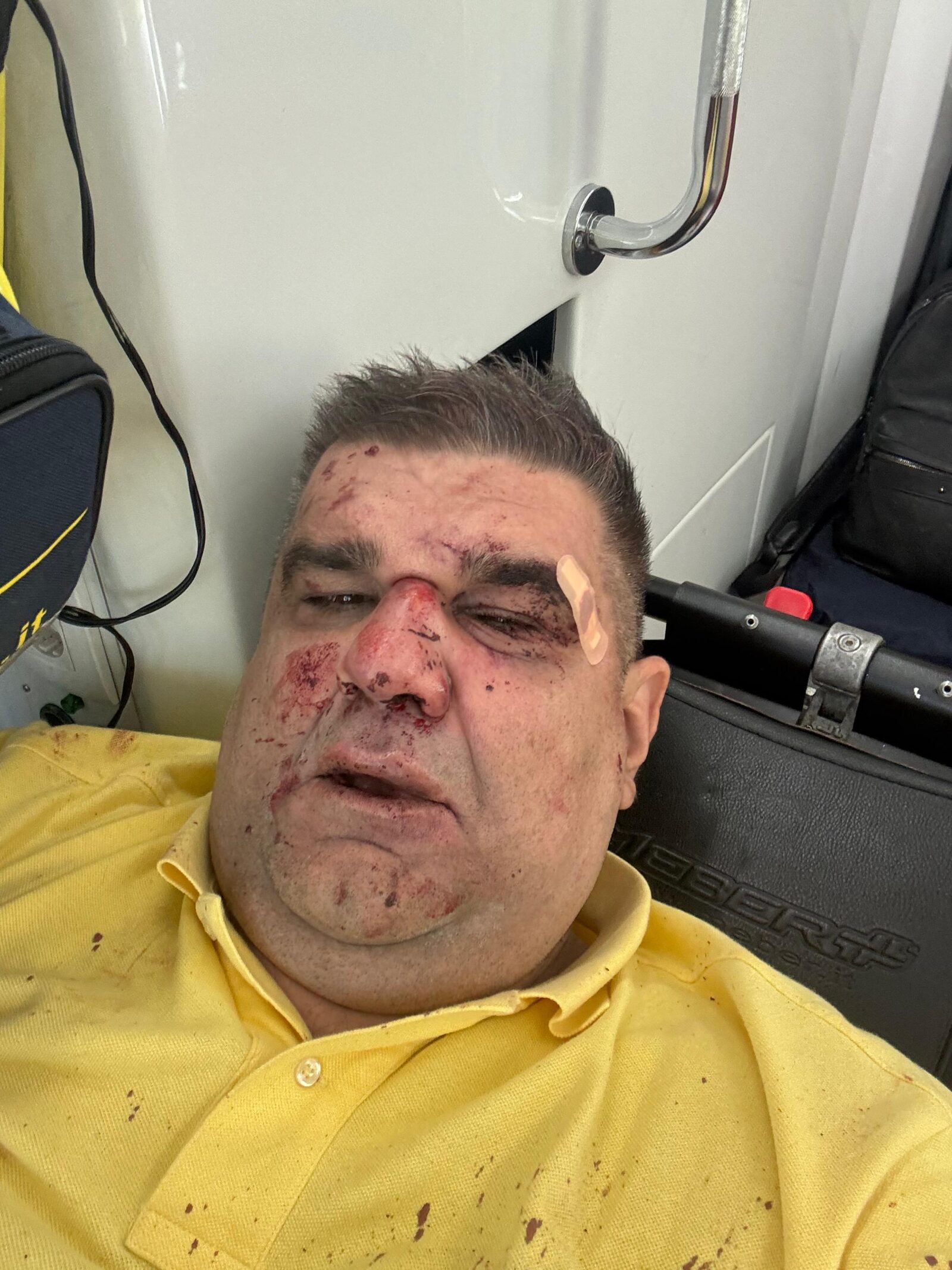 Pokušaj ubistva saše mirkovića Saša Mirković foto:Hype tv/Rikoset.rs