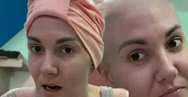 „PREKO 15.000 BOLUJE OD MULTIPLESKLEROZE, a SAMO 20% ima pravo na LEK!“ Katarina do detalja opisala detalje hemoterapije „Plakala sam kada sam se pogledala u ogledalo“