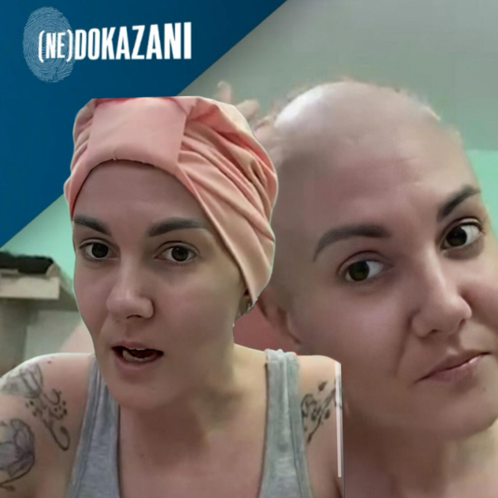 „PREKO 15.000 BOLUJE OD MULTIPLESKLEROZE, a SAMO 20% ima pravo na LEK!“ Katarina do detalja opisala detalje hemoterapije „Plakala sam kada sam se pogledala u ogledalo“