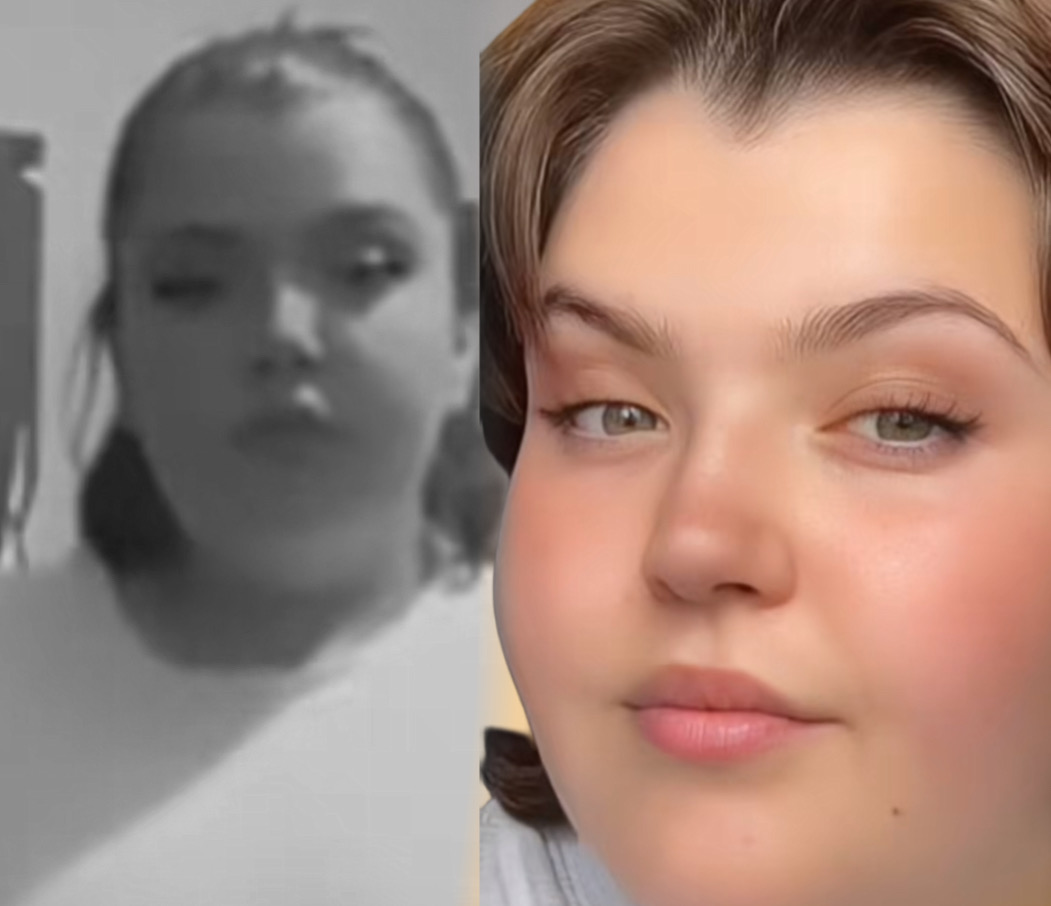 MLADA INFLUENSERKA (20) OTIŠLA NA OPERACIJU SMANJENJA ŽELUCA