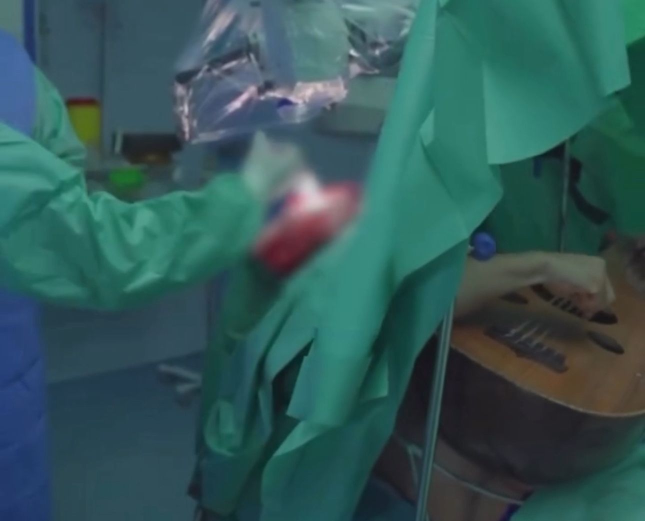 BUDAN TOKOM INTERVENCIJE! PACIJENT SVIRAO GITARU DOK SU MU HIRURZI OPERISALI MOZAK! Čudo savremene hirurgije