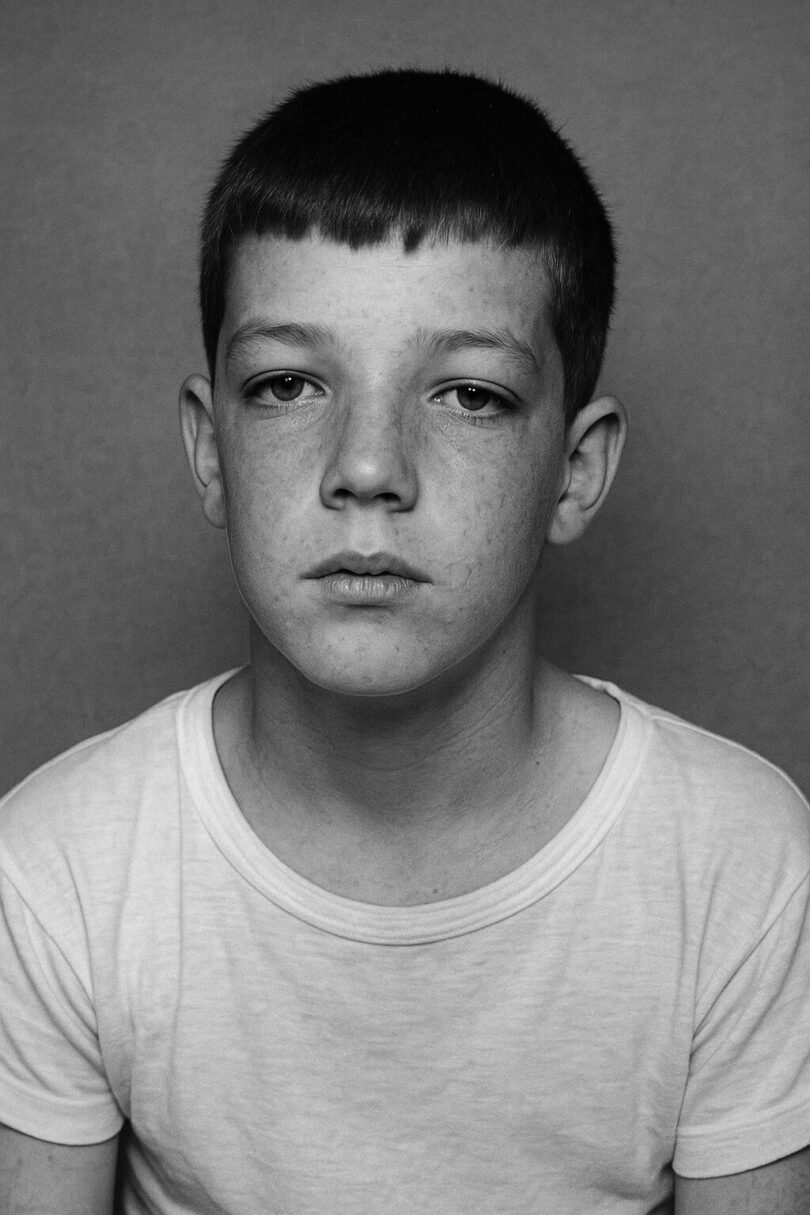 DEČAK (12) je najmlađi PREŽIVELI PACIJENT transorbitalne LOBOTOMIJE
