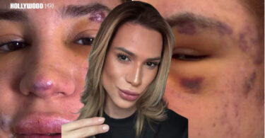 “FOX EYES” ZAHVAT POŠAO PO ZLU: Influenser osetio da nešto nije u redu, a onda je POČEO DA SE GUŠI, proglašen je MRTVIM
