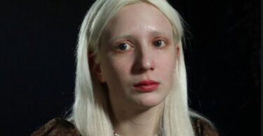 "URINIRALI SU MI PO STVARIMA! MISLE DA SAM ZARAZNA!" Ispovest ALBINO devojke u emisiji "(NE)DOKAZANI"